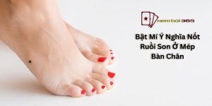 Bật Mí Ý Nghĩa Nốt Ruồi Son Ở Mép Bàn Chân